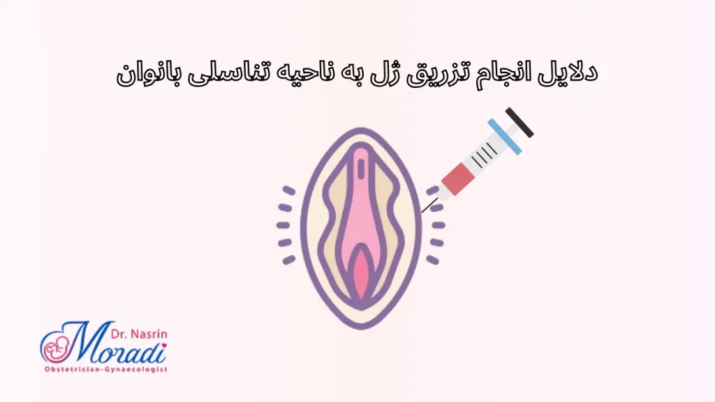 دلایل انجام تزریق ژل به ناحیه تناسلی بانوان