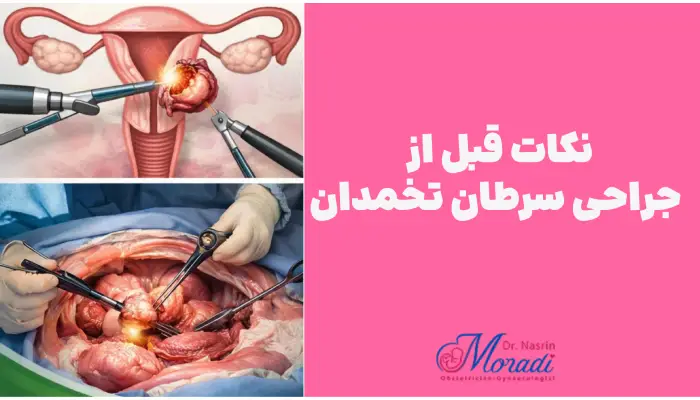 نکات قبل از جراحی سرطان تخمدان