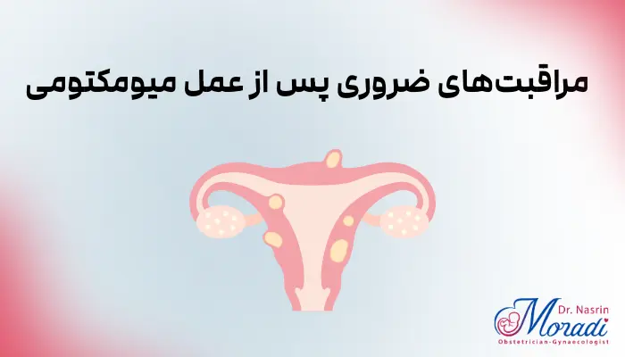 مراقبتهای ضروری پس از عمل میومکتومی
