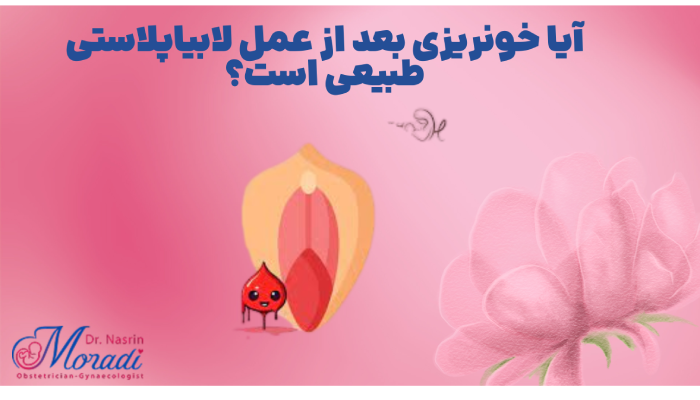 آیا خونریزی بعد از عمل لابیاپلاستی طبیعی است؟