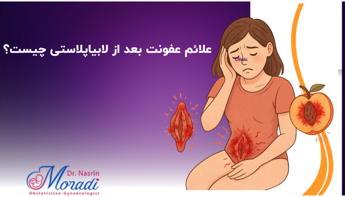 عوارض عفونت بعد از لابیاپلاستی