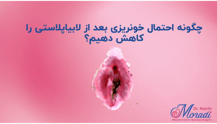 چگونه احتمال خونریزی بعد از لابیاپلاستی را کاهش دهیم؟